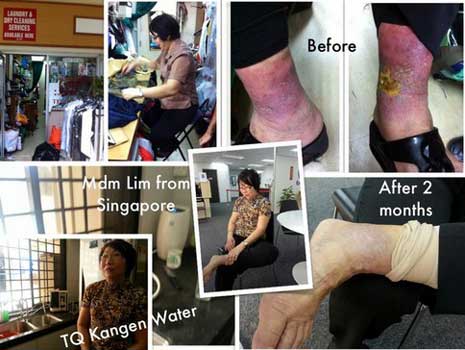 diabetes kencing manis kangen water