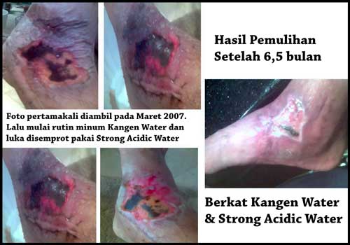 luka borok strong acidic water