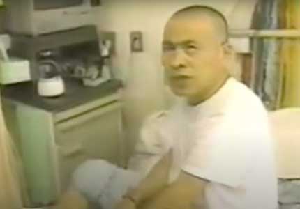 diabetes amputasi mr abe jepang